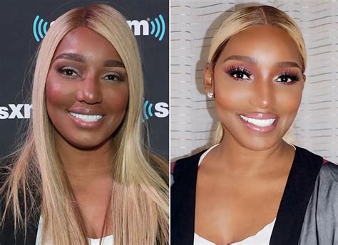 nene leaks before surgery|NeNe Leakes Plastic Surgery Before And After Photos